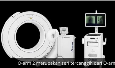 Tangani Skoliosis, Eka Hospital Miliki Teknologi Canggih O-Arm